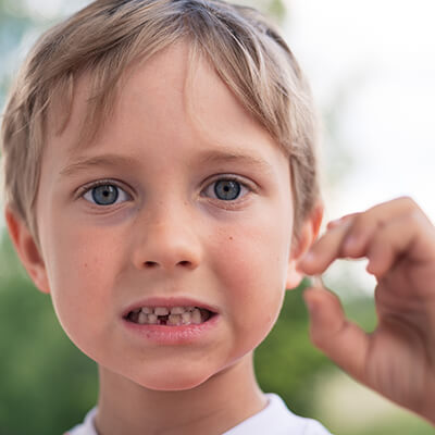 Junge zeigt seinen abgebrochenen Zahn